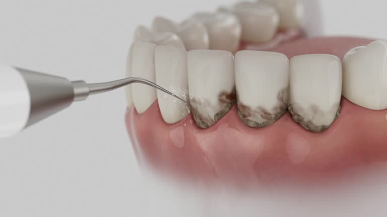 Reliable Dental contractor in Beattystown, NJ by Dentist Open Now